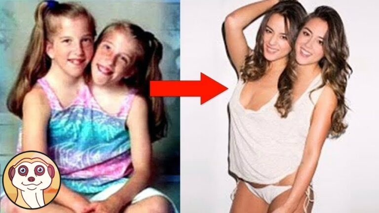 La straordinaria vita di Abigail e Brittany Hensel: il sorprendente destino di due gemelle condivise